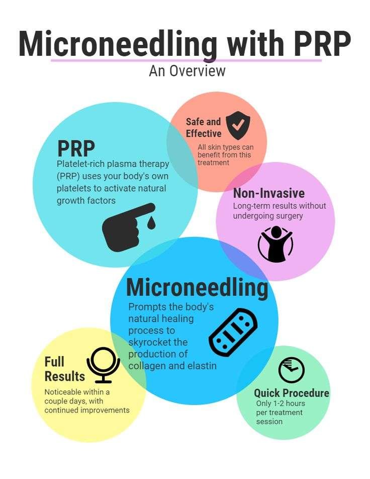 potenza rf microneedling