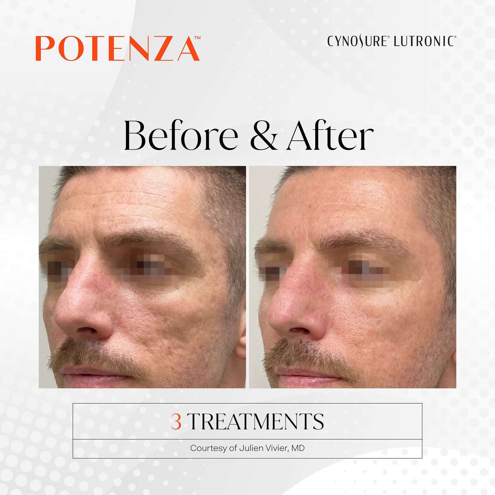 PRD 1655 Potenza BNA Social Media Posts 02