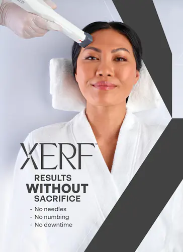 XERF Skin Tightening Results